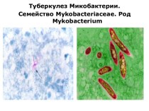 Туберкулез Микобактерии. Семейство Mykobacteriaceae. Род Mykobacterium
