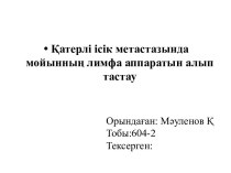 Қатерлі ісік метастазында мойынның лимфа аппаратын алып тастау