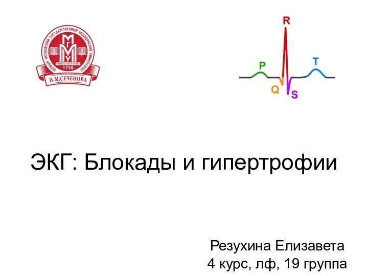 ЭКГ: Блокады и гипертрофии Резухина Елизавета4 курс, лф, 19 группа