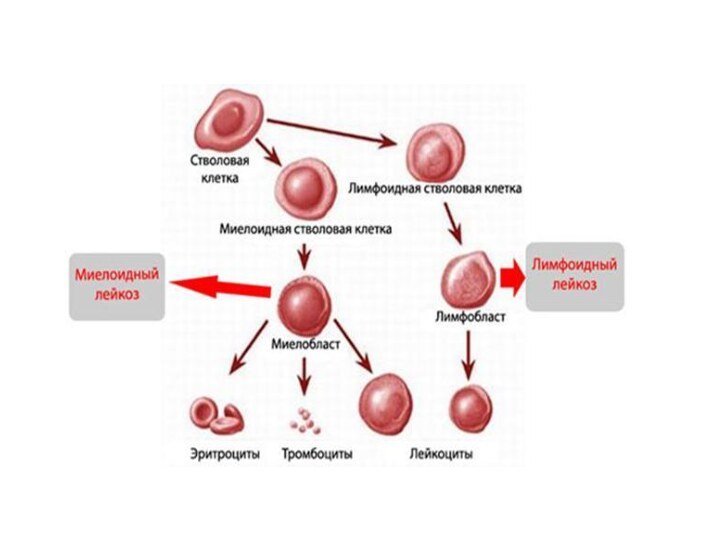 Лейкозы картинки для презентации