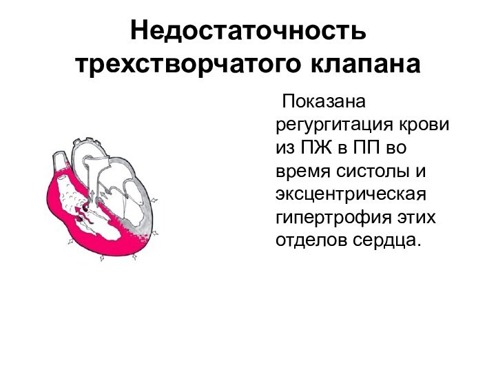 Недостаточность трехстворчатого клапана 	Показана регургитация крови из ПЖ в ПП во время