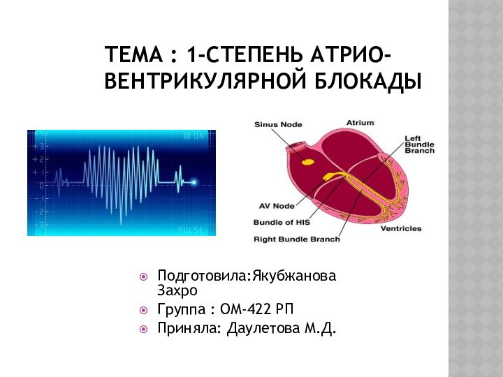 ТЕМА : 1-СТЕПЕНЬ АТРИО-ВЕНТРИКУЛЯРНОЙ БЛОКАДЫПодготовила:Якубжанова Захро Группа : ОМ-422 РППриняла: Даулетова М.Д.