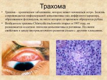 Трахома. Эпидемиология