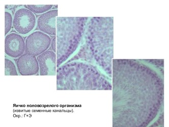 Мужская половая система. Срезы