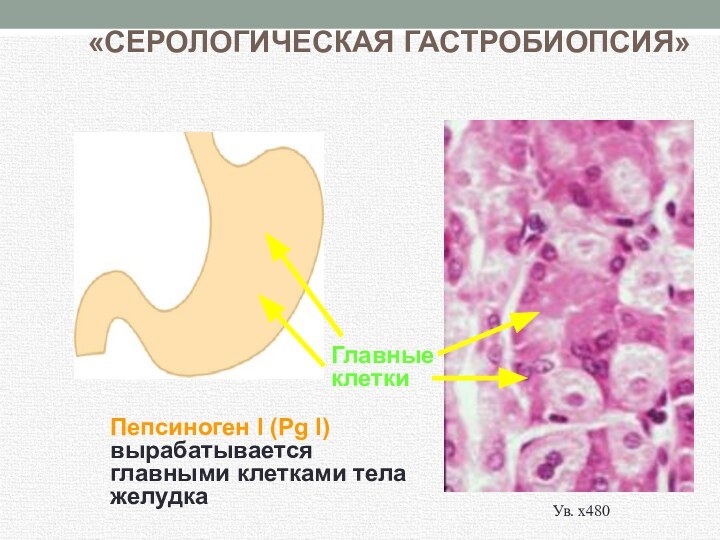 Клетки вырабатывающие пепсиноген. Хронический гастрит презентация. Презентация на тему хронический гастрит.