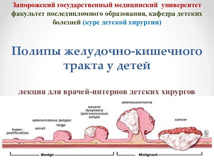 Запорожский государственный медицинский университет факультет последипломного образования, кафедра детских болезней