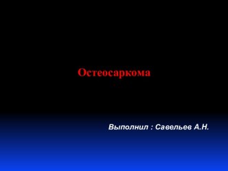 Остеосаркома. Симптомы. Лечение