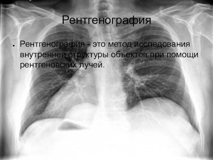РентгенографияРентгенография - это метод исследования внутренней структуры объектов при помощи рентгеновских лучей.