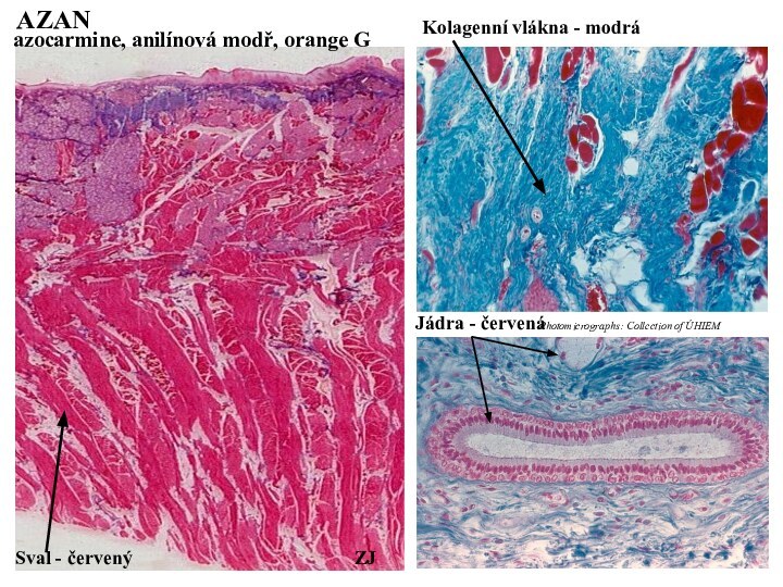 azocarmine, anilínová modř, orange GAZANSval - červenýKolagenní vlákna - modráJádra - červenáPhotomicrographs: Collection of ÚHIEMZJ