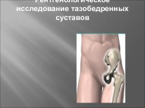Рентгенологическое исследование тазобедренных суставов