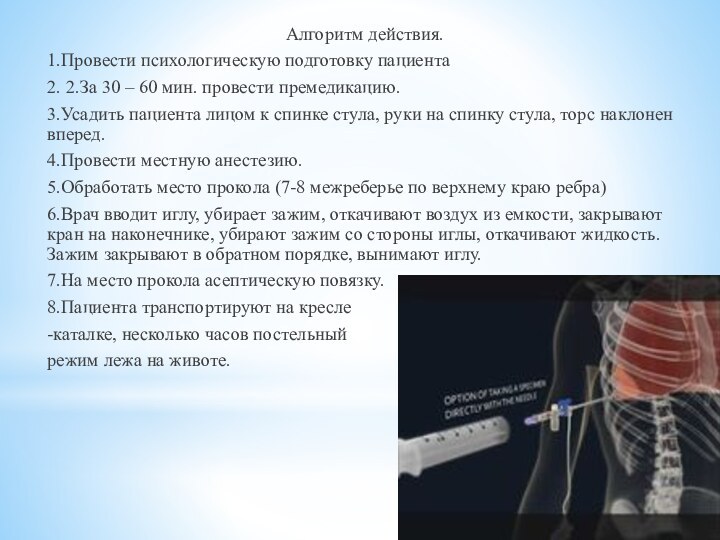 Алгоритм действия.1.Провести психологическую подготовку пациента2. 2.За 30 – 60 мин. провести премедикацию.3.Усадить