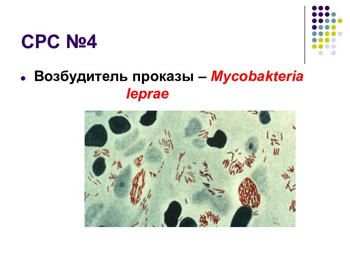 СРС №4Возбудитель проказы – Mycobakteria 							leprae