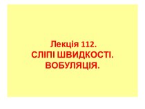 Лекція 112. Сліпі швидкості. Вобуляція