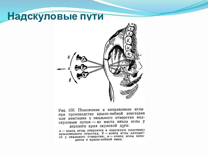 Надскуловые пути