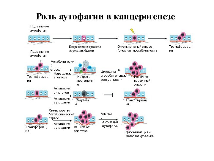 Роль аутофагии в канцерогенезеПодавлениеаутофагииПовреждение органеллАгрегация белковОкислительный стрессГеномная нестабильностьТрансформацияПодавлениеаутофагииТрансформацияМетаболическийстрессНарушениеапоптозаНекроз ивоспалениеЦитокины,способствующиеросту опухолиРазвитиепервичной опухолиАктивацияонкогеновАктивацияаутофагииСтарениеТрансформацияТрансформацияХимиотерапияМетаболическийстрессАктивацияаутофагииЗащита от апоптозаАноикисАктивацияаутофагииДиссеминация и метастазирование