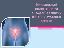 Неправильні положення та аномалії розвитку жіночих статевих органів