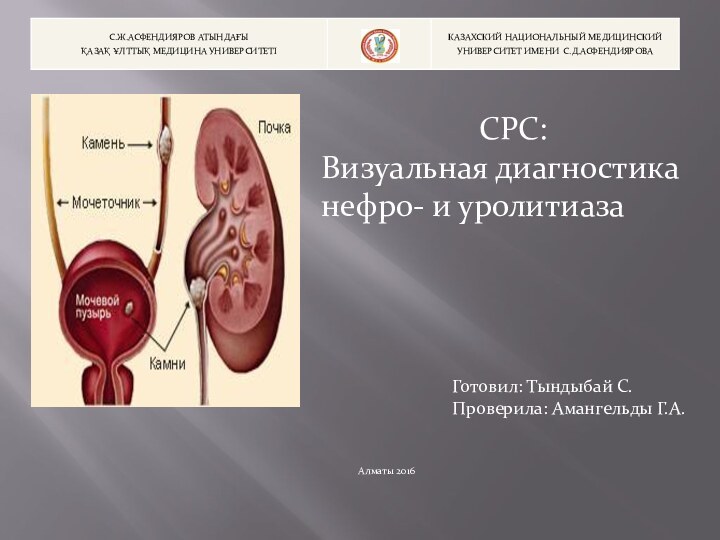 СРС:Визуальная диагностика нефро- и уролитиазаГотовил: Тындыбай С.Проверила: Амангельды Г.А.Алматы 2016