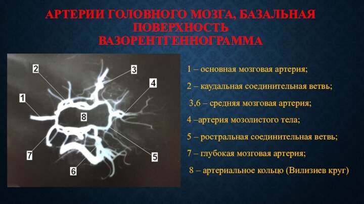 АРТЕРИИ ГОЛОВНОГО МОЗГА, БАЗАЛЬНАЯ ПОВЕРХНОСТЬ  ВАЗОРЕНТГЕННОГРАММА 1 – основная мозговая артерия;