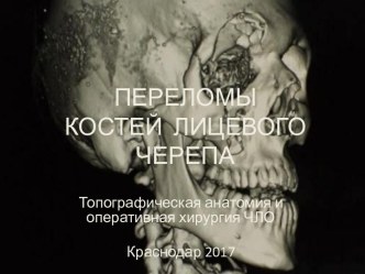 Переломы костей лицевого черепа