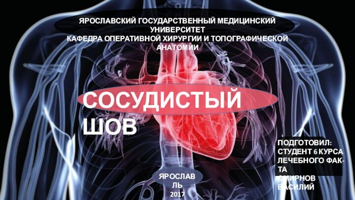 СОСУДИСТЫЙ ШОВЯРОСЛАВСКИЙ ГОСУДАРСТВЕННЫЙ МЕДИЦИНСКИЙ УНИВЕРСИТЕТ КАФЕДРА ОПЕРАТИВНОЙ ХИРУРГИИ И ТОПОГРАФИЧЕСКОЙ АНАТОМИИПОДГОТОВИЛ: СТУДЕНТ