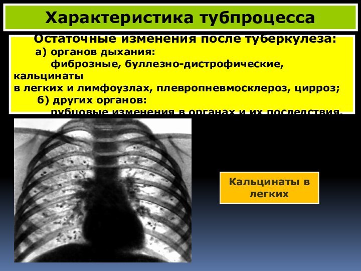 Остаточные изменения после туберкулеза:    а) органов