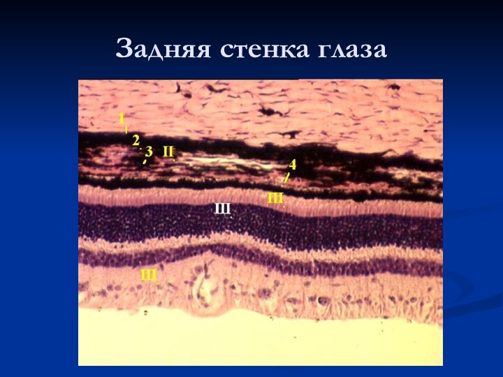 Задняя стенка глаза