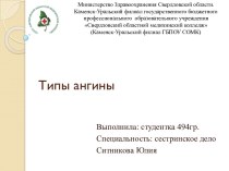 Типы ангины