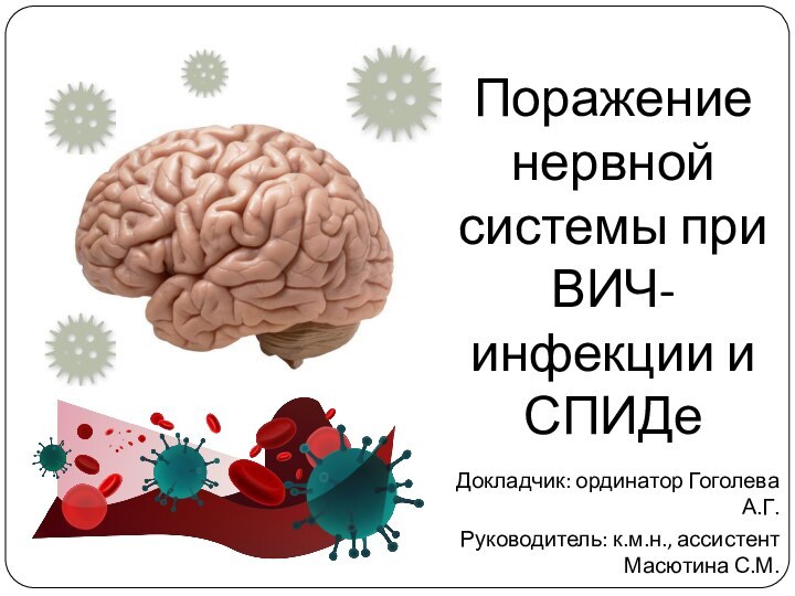 Докладчик: ординатор Гоголева А.Г.Руководитель: к.м.н., ассистент Масютина С.М.Поражение нервной системы при ВИЧ-инфекции и СПИДе