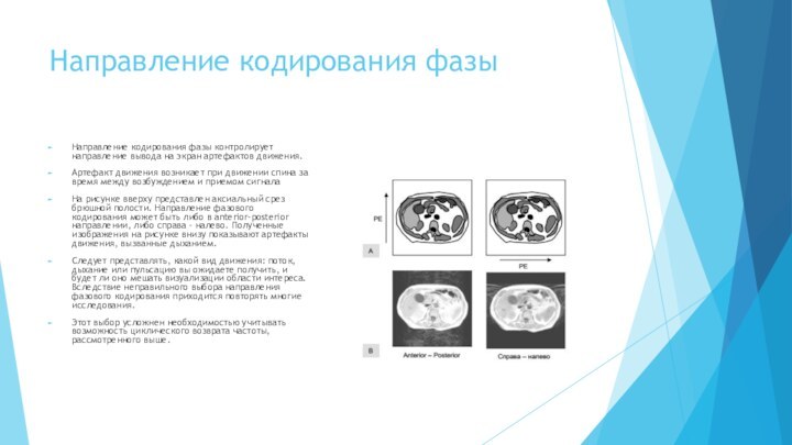 Направление кодирования фазыНаправление кодирования фазы контролирует направление вывода на экран артефактов движения.Артефакт