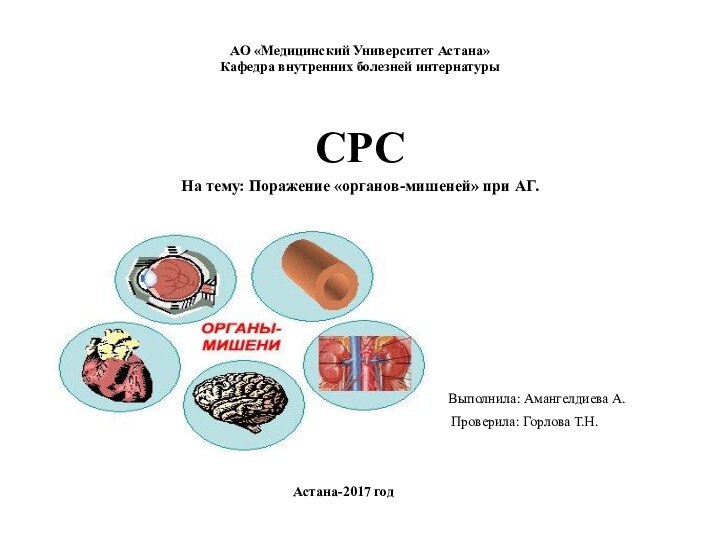 АО «Медицинский Университет Астана» Кафедра внутренних болезней интернатурыCРСНа тему: Поражение «органов-мишеней» при