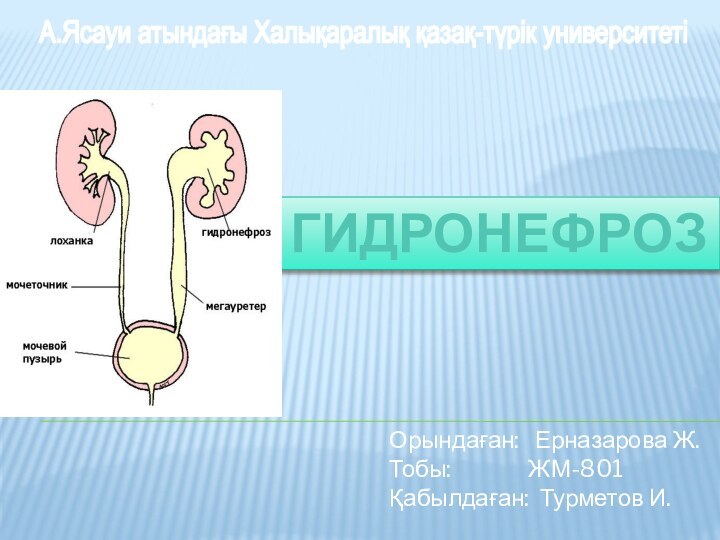 А.Ясауи атындағы Халықаралық қазақ-түрік университетіГИДРОНЕФРОЗОрындаған:  Ерназарова Ж.  Тобы: