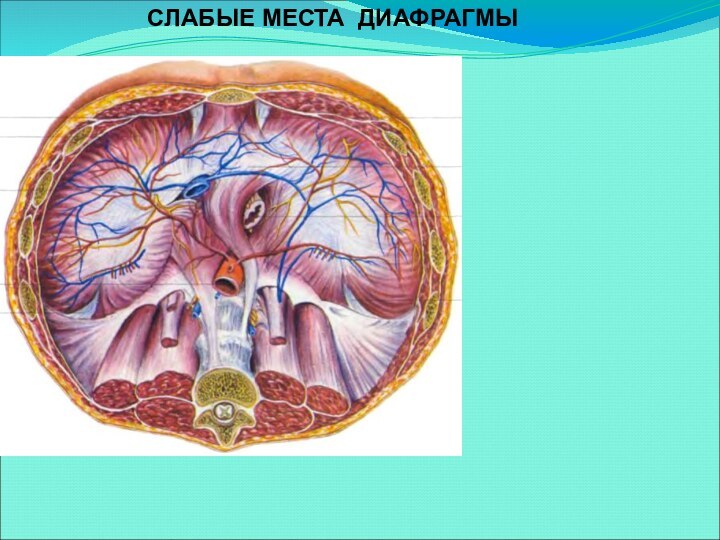 СЛАБЫЕ МЕСТА ДИАФРАГМЫ