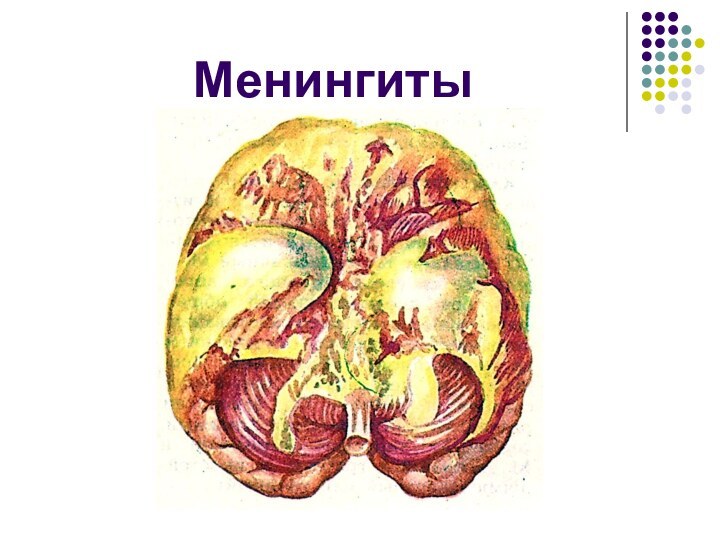 Менингиты