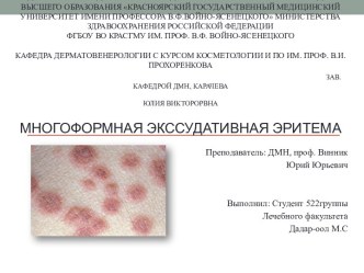 Многоформная экссудативная эритема