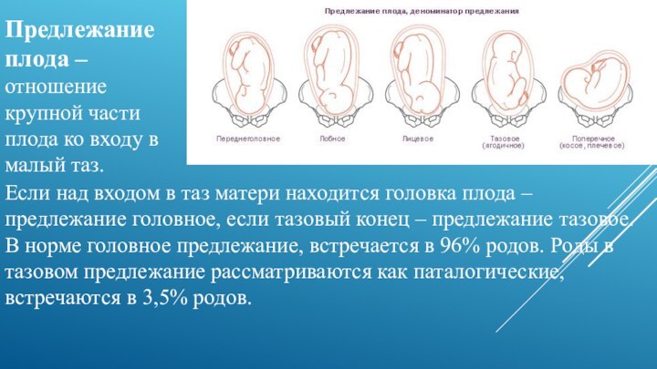 Предлежание плода – отношение крупной части плода ко входу в малый таз.