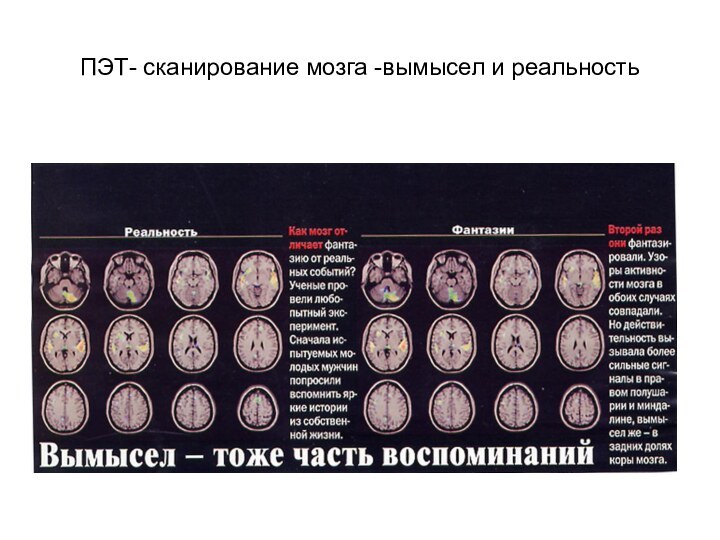 ПЭТ- сканирование мозга -вымысел и реальность