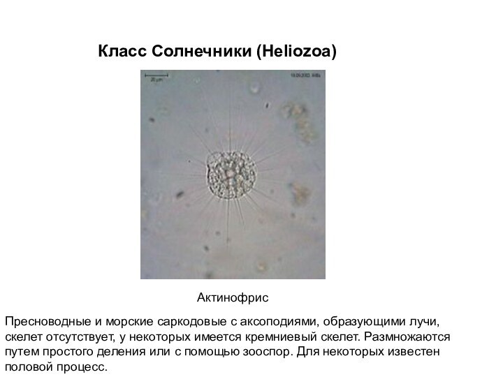 АктинофрисКласс Солнечники (Heliozoa)Пресноводные и морские саркодовые с аксоподиями, образующими лучи, скелет отсутствует,