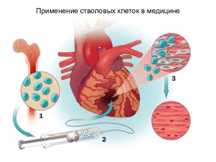 Применение стволовых клеток в медицине