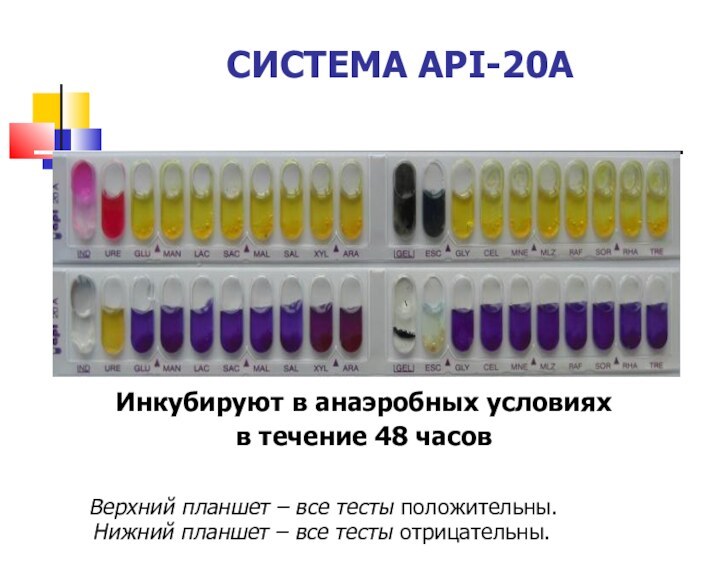 Инкубируют в анаэробных условиях в течение 48 часов  Верхний планшет –