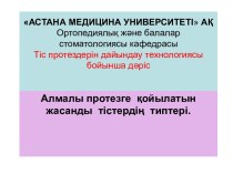 Алмалы протезге қойылатын жасанды тістердің типтері