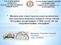 Жоғарғы және төменгі жақтың альвеола өсіндісімен ауыз қуысының шырышты қабығын тексеру әдістері