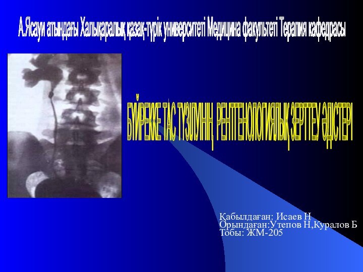 Қабылдаған: Исаев НОрындаған:Утепов Н,Куралов БТобы: ЖМ-205А.Ясауи атындағы Халықаралық қазақ-түрік университеті Медицина факультеті