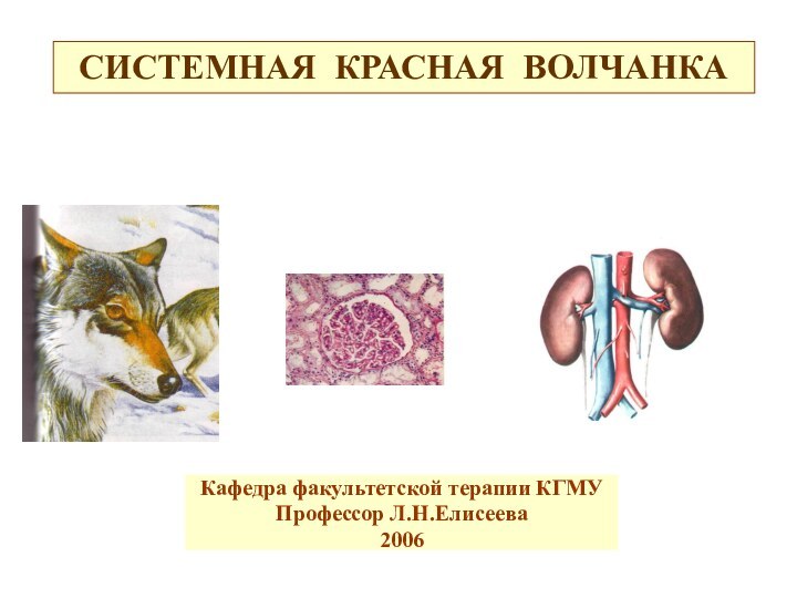 СИСТЕМНАЯ КРАСНАЯ ВОЛЧАНКАКафедра факультетской терапии КГМУПрофессор Л.Н.Елисеева2006