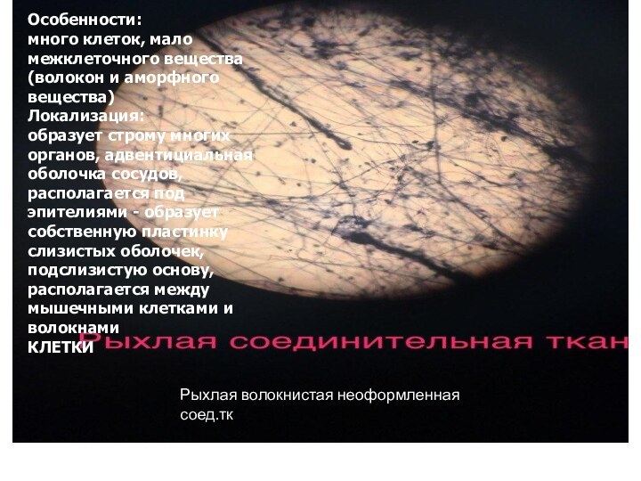 Рыхлая волокнистая неоформленная соед.ткОсобенности: много клеток, мало межклеточного вещества (волокон и аморфного