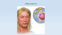 Мастоцитоз. Этиология и патогенез