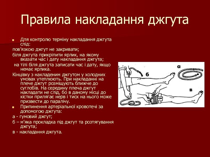 Правила накладання джгутаДля контролю терміну накладання джгута слід: пов’язкою джгут не закривати;