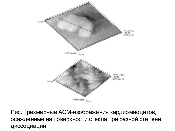 Рис. Трехмерные АСМ-изображения кардиомиоцитов, осажденные на поверхности стекла при разной степени диссоциации