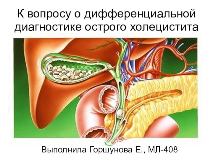 К вопросу о дифференциальной диагностике острого холециститаВыполнила Горшунова Е., МЛ-408