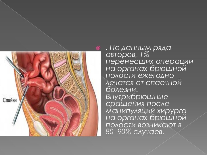 . По данным ряда авторов, 1% перенесших операции на органах брюшной полости