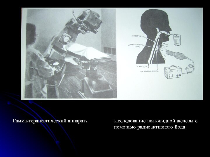 Гамма-терапевтический аппарат.Исследование щитовидной железы с помощью радиоактивного йода